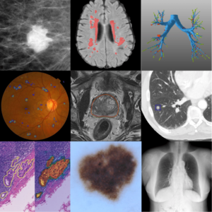 Composite of medical images